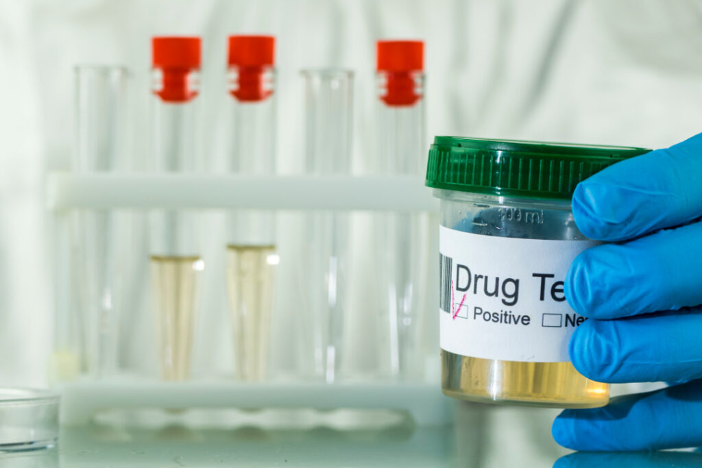 Will THCV Make You Fail a Drug Test?