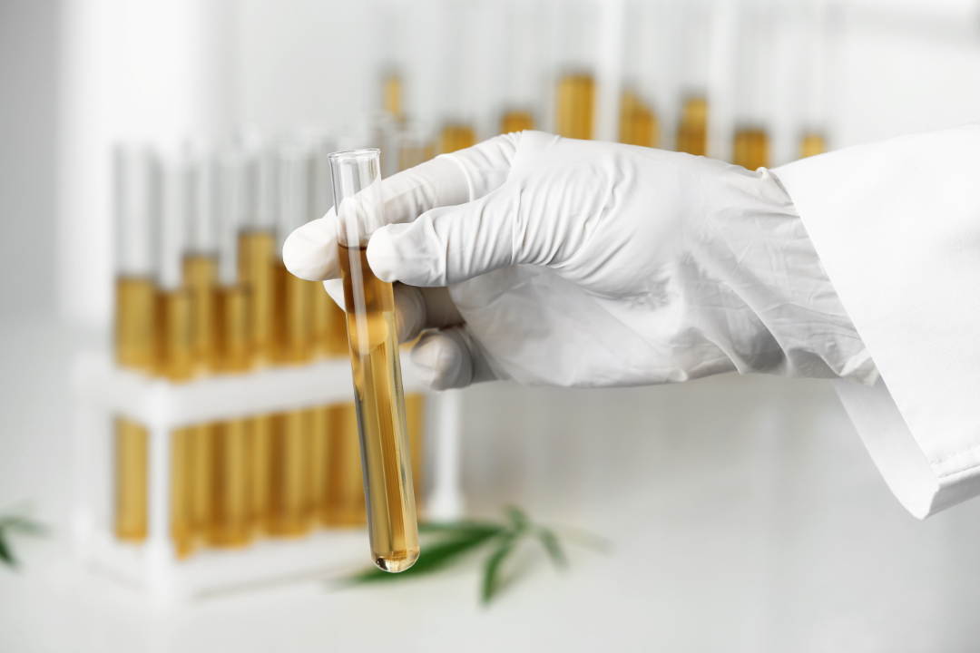 What Factors Affect How Long Cannabis Is Detectable?