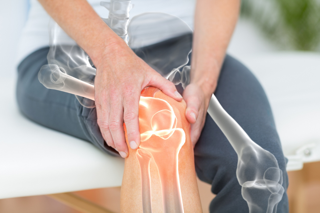 Can CBD help with Arthritis pain? Benefits, Use & Side Effects